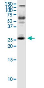 IL23A Antibody in Western Blot (WB)