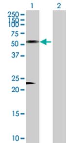 AZIN1 Antibody in Western Blot (WB)