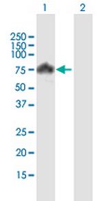 PIAS4 Antibody in Western Blot (WB)