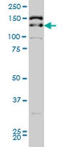 TRIM33 Antibody in Western Blot (WB)