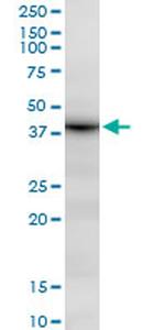 DHRS7 Antibody in Western Blot (WB)