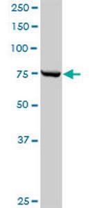 CPSF3 Antibody in Western Blot (WB)