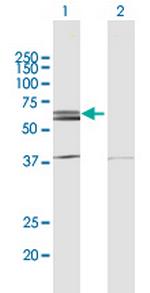 NLK Antibody in Western Blot (WB)