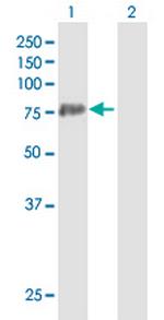 PADI3 Antibody in Western Blot (WB)