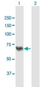 ACSL5 Antibody in Western Blot (WB)