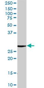 RAB23 Antibody in Western Blot (WB)