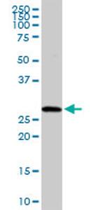 RAB23 Antibody in Western Blot (WB)