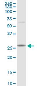 RAB23 Antibody in Western Blot (WB)