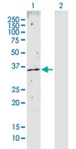 CAB39 Antibody in Western Blot (WB)