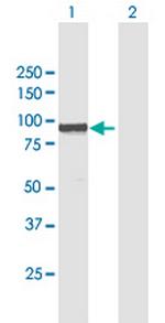 WBP11 Antibody in Western Blot (WB)