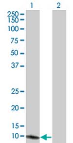 SEPX1 Antibody in Western Blot (WB)