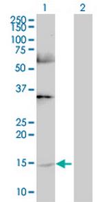 GHRL Antibody in Western Blot (WB)