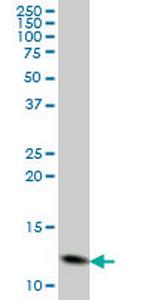 GHRL Antibody in Western Blot (WB)