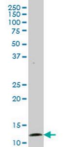 GHRL Antibody in Western Blot (WB)