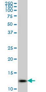 GHRL Antibody in Western Blot (WB)