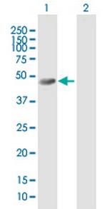 INPP5K Antibody in Western Blot (WB)