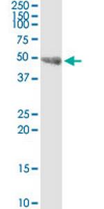 INPP5K Antibody in Western Blot (WB)