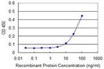 ZAK Antibody in ELISA (ELISA)