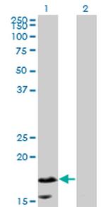 CALML5 Antibody in Western Blot (WB)