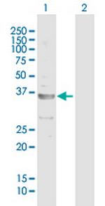 CECR1 Antibody in Western Blot (WB)