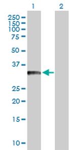 BCL11A Antibody in Western Blot (WB)