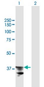 ADAM22 Antibody in Western Blot (WB)