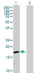 IL20RB Antibody in Western Blot (WB)