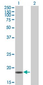 PPIL3 Antibody in Western Blot (WB)