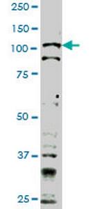 TLR9 Antibody in Western Blot (WB)