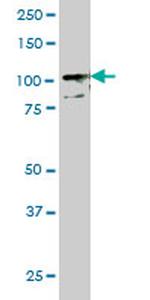 TLR9 Antibody in Western Blot (WB)