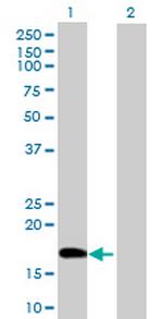 POLE3 Antibody in Western Blot (WB)