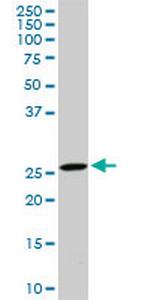 DCUN1D1 Antibody in Western Blot (WB)