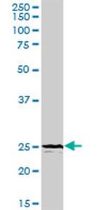 TREM1 Antibody in Western Blot (WB)