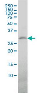 TREM1 Antibody in Western Blot (WB)