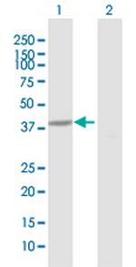 HAO1 Antibody in Western Blot (WB)