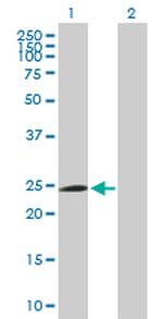 FBXO42 Antibody in Western Blot (WB)