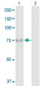 FBXO42 Antibody in Western Blot (WB)