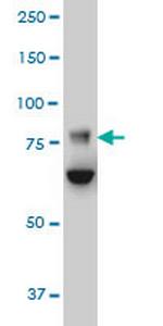 FBXO42 Antibody in Western Blot (WB)