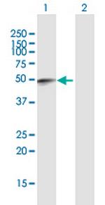 FAM134B Antibody in Western Blot (WB)