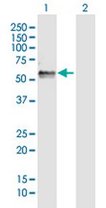 FAM134B Antibody in Western Blot (WB)