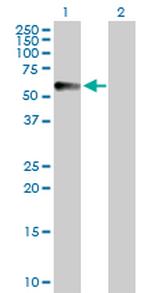 CPVL Antibody in Western Blot (WB)