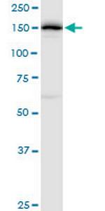 DHX29 Antibody in Western Blot (WB)