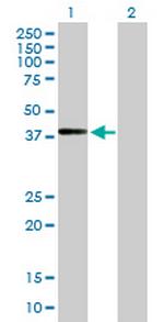 ADAMTSL4 Antibody in Western Blot (WB)