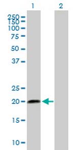 SCAND2 Antibody in Western Blot (WB)