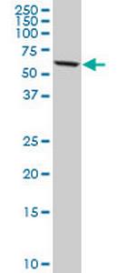 DDX56 Antibody in Western Blot (WB)