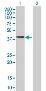 WDR74 Antibody in Western Blot (WB)