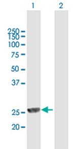 MPHOSPH8 Antibody in Western Blot (WB)