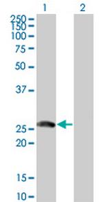 BTG4 Antibody in Western Blot (WB)