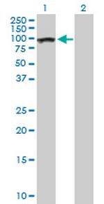 AHI1 Antibody in Western Blot (WB)