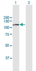 DPP8 Antibody in Western Blot (WB)